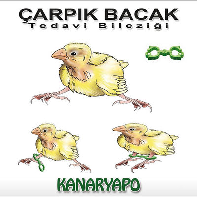 Kanarya Çarpık Bacak Tedavi Bileziği No: 3